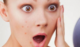 吃瓜嘴角红疙瘩,嘴角红疙瘩揭秘